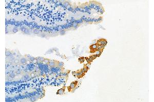 ABIN6262288 and ABIN6277150 at 1/100 staining Rat colorectal tissue by IHC-P.
