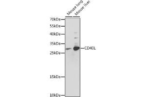Western blot analysis of extracts of various cell lines, using CD40L antibody (ABIN3020936, ABIN3020937, ABIN3020938 and ABIN6213807) at 1:400 dilution.