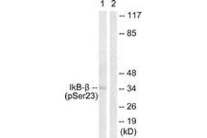 Western blot analysis of extracts from HeLa cells treated with TNF-a 20ng/ml 5', using IkappaB-beta (Phospho-Ser23) Antibody. (NFKBIB 抗体  (pSer23))