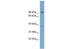 WB Suggested Anti-RTDR1 Antibody Titration: 0. (RTDR1 抗体  (N-Term))