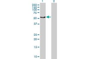 Western Blot analysis of SNX4 expression in transfected 293T cell line by SNX4 MaxPab polyclonal antibody. (Sorting Nexin 4 抗体  (AA 1-450))