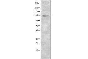 Western blot analysis SLC39A10 using HepG2 whole cell lysates (SLC39A10 抗体  (Internal Region))