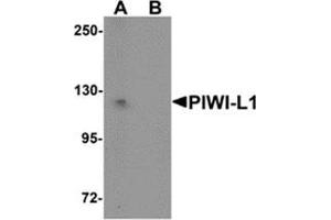 Western blot analysis of PIWI-L1 in HepG2 cell lysate with PIWI-L1 antibody at 1 μg/ml in (A) the absence and (B) the presence of blocking peptide. (PIWIL1 抗体  (N-Term))