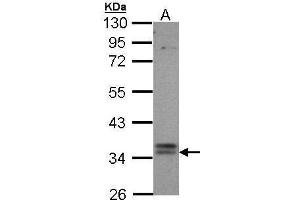 WB Image Sample (30 ug of whole cell lysate) A: Hep G2 , 10% SDS PAGE antibody diluted at 1:1000 (GPBAR1 抗体  (C-Term))