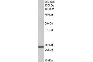 ABIN2563394 (1µg/ml) staining of Human Bone Marrow lysate (35µg protein in RIPA buffer). (IL-15 抗体  (AA 70-82))