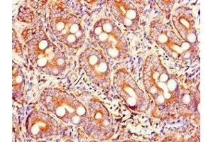 Immunohistochemistry of paraffin-embedded human small intestine tissue using ABIN7173598 at dilution of 1:100 (PRSS2 抗体  (AA 24-247))