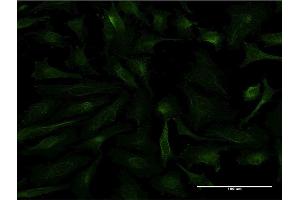 Immunofluorescence of monoclonal antibody to FTL on HeLa cell. (FTL 抗体)