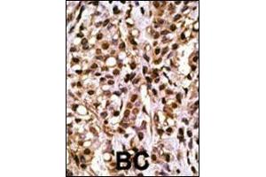 Immunohistochemistry (Paraffin-embedded Sections) (IHC (p)) image for anti-Autophagy related 4A Cysteine Peptidase (ATG4A) (AA 363-392) antibody (ABIN388493)