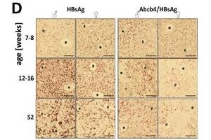 Immunohistochemistry (IHC) image for anti-Hepatitis B Virus Surface Antigen (HBsAg) antibody (ABIN285516)
