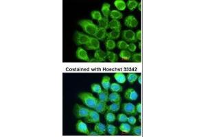 ICC/IF Image Immunofluorescence analysis of methanol-fixed A431, using Complement C2, antibody at 1:200 dilution. (Complement C2 抗体)