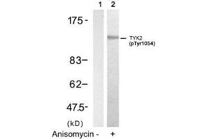 Western blot analysis of extracts from HT29 cells untreated(lane 1) or treated with Anisomycin(lane 2) using TYK2(Phospho-Tyr1054) Antibody. (TYK2 抗体  (pTyr1054))