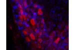 Expression of Galanin receptor 2 in rat DRG - Immunohistochemical staining of rat dorsal root ganglia (DRG) frozen sections using Anti-GALR2 Antibody (ABIN7043181, ABIN7044398 and ABIN7044399), (1:100). (GALR2 抗体  (3rd Intracellular Loop))