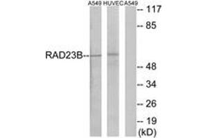 Western blot analysis of extracts from A549/HuvEc cells, using RAD23B Antibody. (RAD23B 抗体  (AA 1-50))