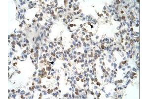 Image no. 1 for anti-Distal-Less Homeobox 5 (DLX5) (AA 120-169) antibody (ABIN6737699) (DLX5 抗体  (AA 120-169))