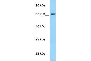 WB Suggested Anti-CLPX Antibody Titration: 1. (CLPX 抗体  (C-Term))