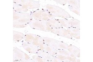Immunohistochemistry of paraffin embedded mouse Skeletal muscle using Troponin I (ABIN7076031) at dilution of 1:700 (400x lens) (TNNI2 抗体)