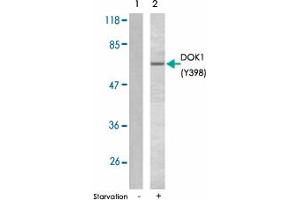 Western blot analysis of extracts from K-562 cells using DOK1 (phospho Y398) polyclonal antibody . (DOK1 抗体  (pTyr398))