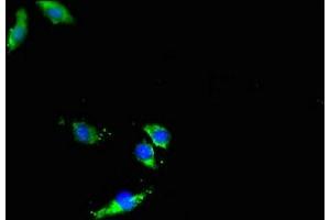 Immunofluorescent analysis of Hela cells using ABIN7150108 at dilution of 1:100 and Alexa Fluor 488-congugated AffiniPure Goat Anti-Rabbit IgG(H+L) (DNMT3L 抗体  (AA 1-234))