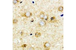 Immunohistochemical analysis of Transcobalamin-2 staining in mouse brain formalin fixed paraffin embedded tissue section. (TCN2 抗体)