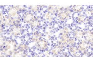 Detection of PCSK9 in Rat Kidney Tissue using Polyclonal Antibody to Proprotein Convertase Subtilisin/Kexin Type 9 (PCSK9) (PCSK9 抗体  (AA 164-428))