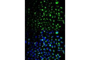 Immunofluorescence analysis of U2OS cells using HK1 antibody. (Hexokinase 1 抗体  (AA 20-300))
