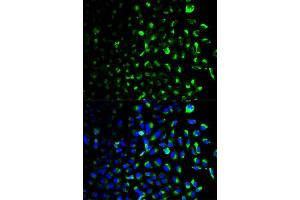 Immunofluorescence analysis of U2OS cells using HK1 antibody. (Hexokinase 1 抗体  (AA 20-300))