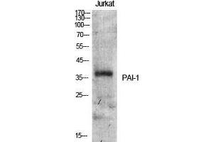 Western Blot (WB) analysis of specific cells using PAI-1 Polyclonal Antibody. (PAI1 抗体  (Internal Region))