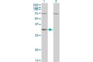 Western Blot analysis of SDR16C5 expression in transfected 293T cell line by RDHE2 monoclonal antibody (M01), clone 3G8. (SDR16C5 抗体  (AA 26-309))