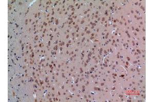 Immunohistochemistry (IHC) analysis of paraffin-embedded Rat Brain, antibody was diluted at 1:100. (Arginine 抗体  (Internal Region))