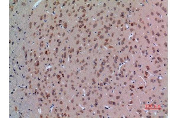 Arginine 抗体  (Internal Region)