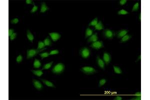 Immunofluorescence of monoclonal antibody to AKAP13 on HeLa cell. (AKAP13 抗体  (AA 1-110))