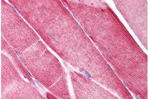 Immunohistochemistry (Paraffin-embedded Sections) (IHC (p)) image for anti-Voltage-Dependent Anion Channel 2 (VDAC2) (N-Term) antibody (ABIN6736446)