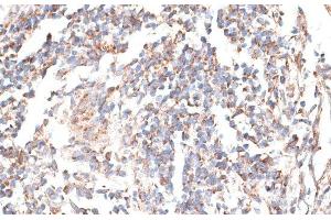 Immunohistochemistry of paraffin-embedded Human tonsil using KATNA1 Polyclonal Antibody at dilution of 1:100 (40x lens). (KATNA1 抗体)