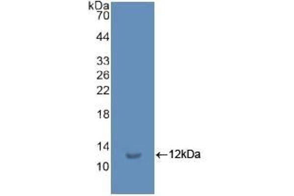 Ubiquitin 抗体  (AA 1-229)