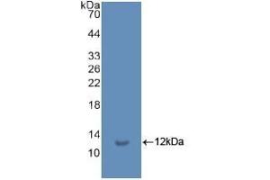 Detection of Recombinant Ub, Human using Polyclonal Antibody to Ubiquitin (Ub) (Ubiquitin 抗体  (AA 1-229))