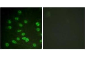 Immunofluorescence analysis of HuvEc cells treated with serum 20% 30', using DDX3/DEAD-box Protein 3 (Phospho-Thr322) Antibody. (DDX3 抗体  (pThr322))
