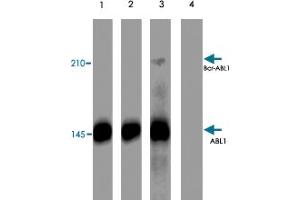 Western blot analysis of K-562 cells treated with pervanadate (1 mM) for 30 minutes (lanes 1 & 3). (ABL1 抗体  (pTyr245))