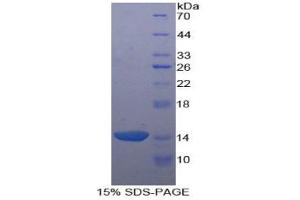 SDS-PAGE analysis of Human Agouti Related Protein. (AGRP 蛋白)