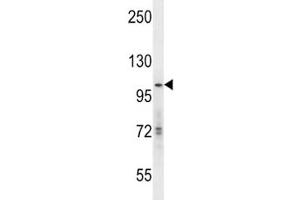 hGCN5 antibody western blot analysis in mouse Neuro-2a lysate. (KAT2A 抗体  (AA 807-837))