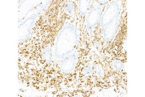 Immunohistochemistry (IHC) image for anti-Protein tyrosine Phosphatase, Receptor Type, C (PTPRC) (C-Term) antibody (ABIN7454030)