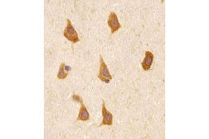 (ABIN656506 and ABIN2845778) staining PREX1 in human brain tissue sections by Immunohistochemistry (IHC-P - paraformaldehyde-fixed, paraffin-embedded sections).