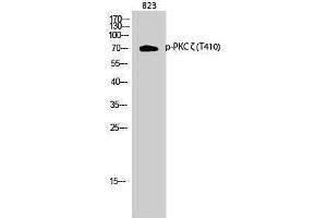 Western Blotting (WB) image for anti-Protein Kinase C, zeta (PRKCZ) (pThr410) antibody (ABIN3179493) (PKC zeta 抗体  (pThr410))