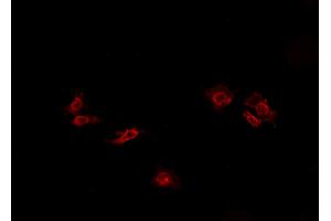 ABIN6269088 staining HeLa cells by IF/ICC. (ATP1A1 抗体  (N-Term))