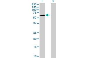 Western Blot analysis of IGHA2 expression in transfected 293T cell line by IGHA2 MaxPab polyclonal antibody. (IGHA2 抗体  (AA 1-477))