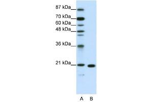 RPL9 antibody used at 1. (RPL9 抗体  (C-Term))