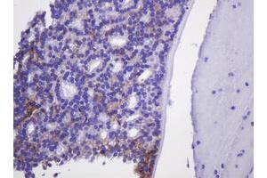 Image no. 2 for anti-Carbonic Anhydrase 12 (CA12) antibody (ABIN1497067) (CA12 抗体)