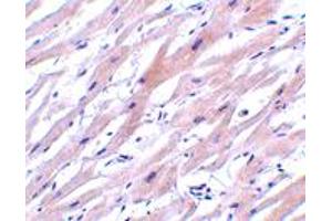Immunohistochemistry of UNG in human heart tissue with UNG polyclonal antibody  at 2 ug/mL . (UNG 抗体  (N-Term))