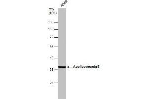 WB Image Whole cell extract (30 μg) was separated by 10% SDS-PAGE, and the membrane was blotted with Apolipoprotein E antibody , diluted at 1:1000. (APOE 抗体  (N-Term))