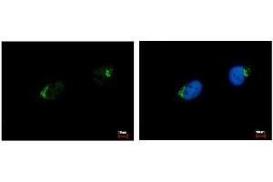 ICC/IF Image GALNT7 antibody [N1C2] detects GALNT7 protein at Golgi apparatus by immunofluorescent analysis. (GALNT7 抗体  (Center))
