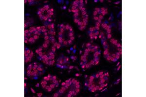 Immunofluorescence (IF) image for anti-gamma Histone Variant H2AX (GAMMA-H2AX) (Ser140) antibody (ABIN7455200) (Recombinant gamma H2AX 抗体  (Ser140))